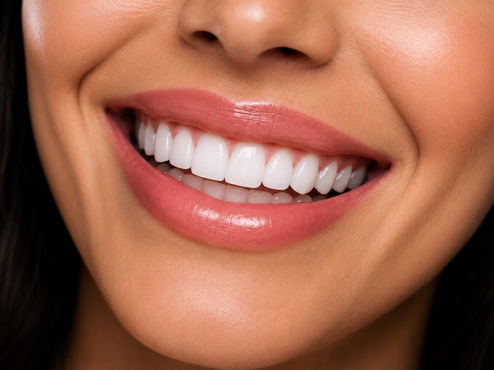 Estética dental, sorriso natural